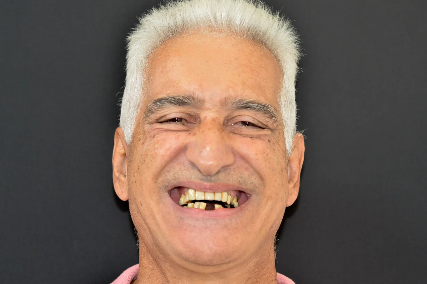 Antes do tratamento — caso 05